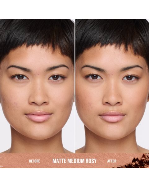 placeholder-image